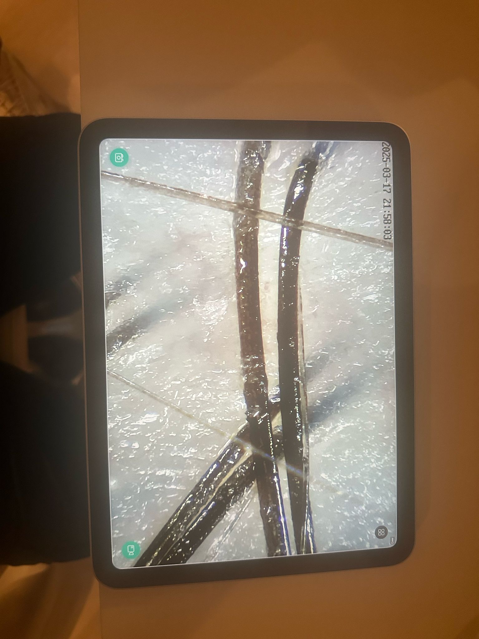 Hoofdharen scan voor een behandeling